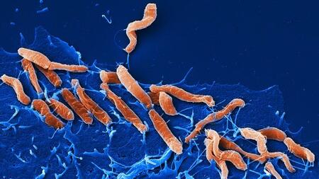 Wie der Magenkeim Helicobacter pylori Krankheiten auslösen kann ...